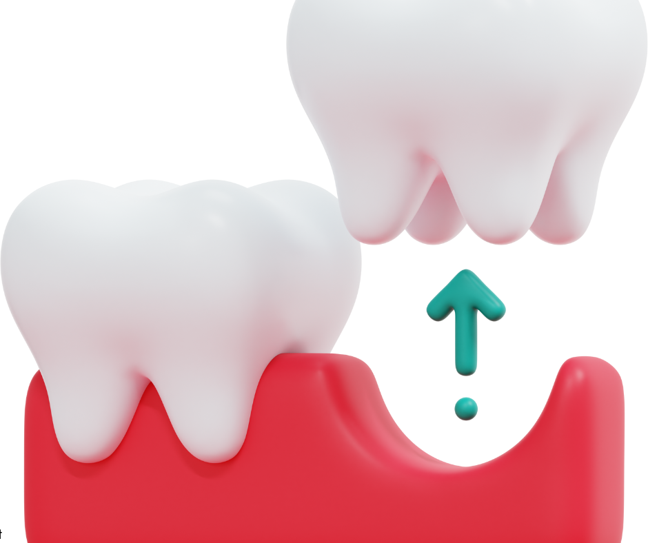 Tooth Extractions in Sacramento