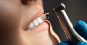 Dental Cleaning - Emergency Dental of Sacramento