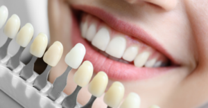 Whitening - Emergency Dental of Sacramento